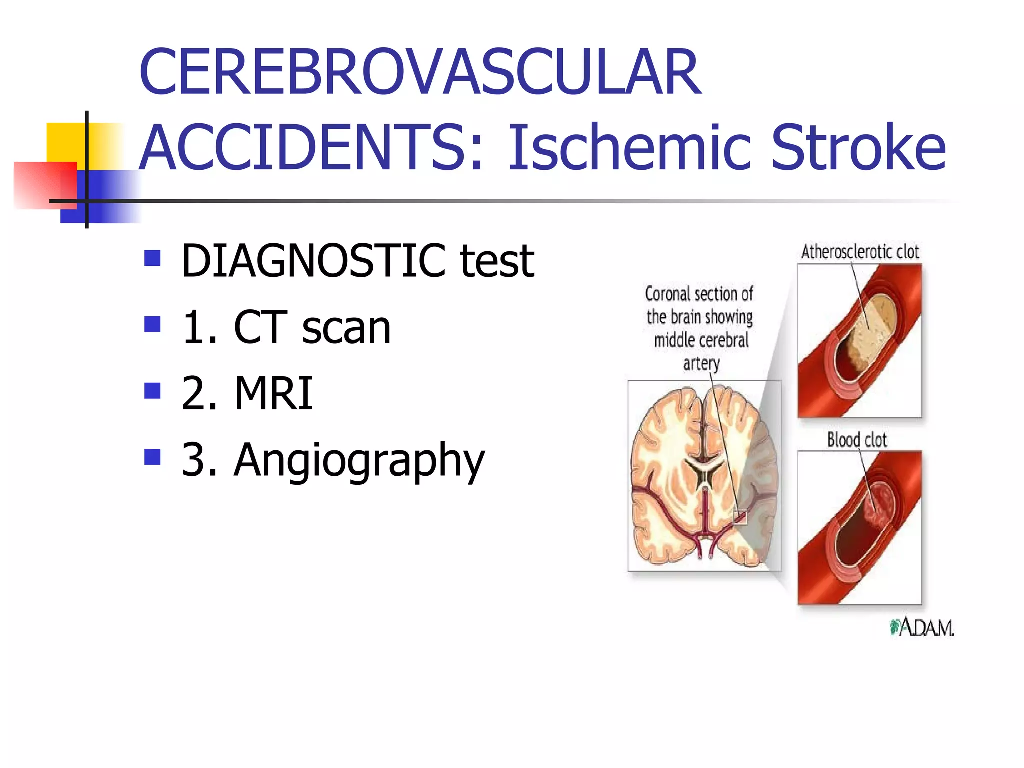 CEREBROVASCULAR ACCIDENTS: Ischemic Stroke DIAGNOSTIC test 1. CT scan 2. MRI 3. Angiography 