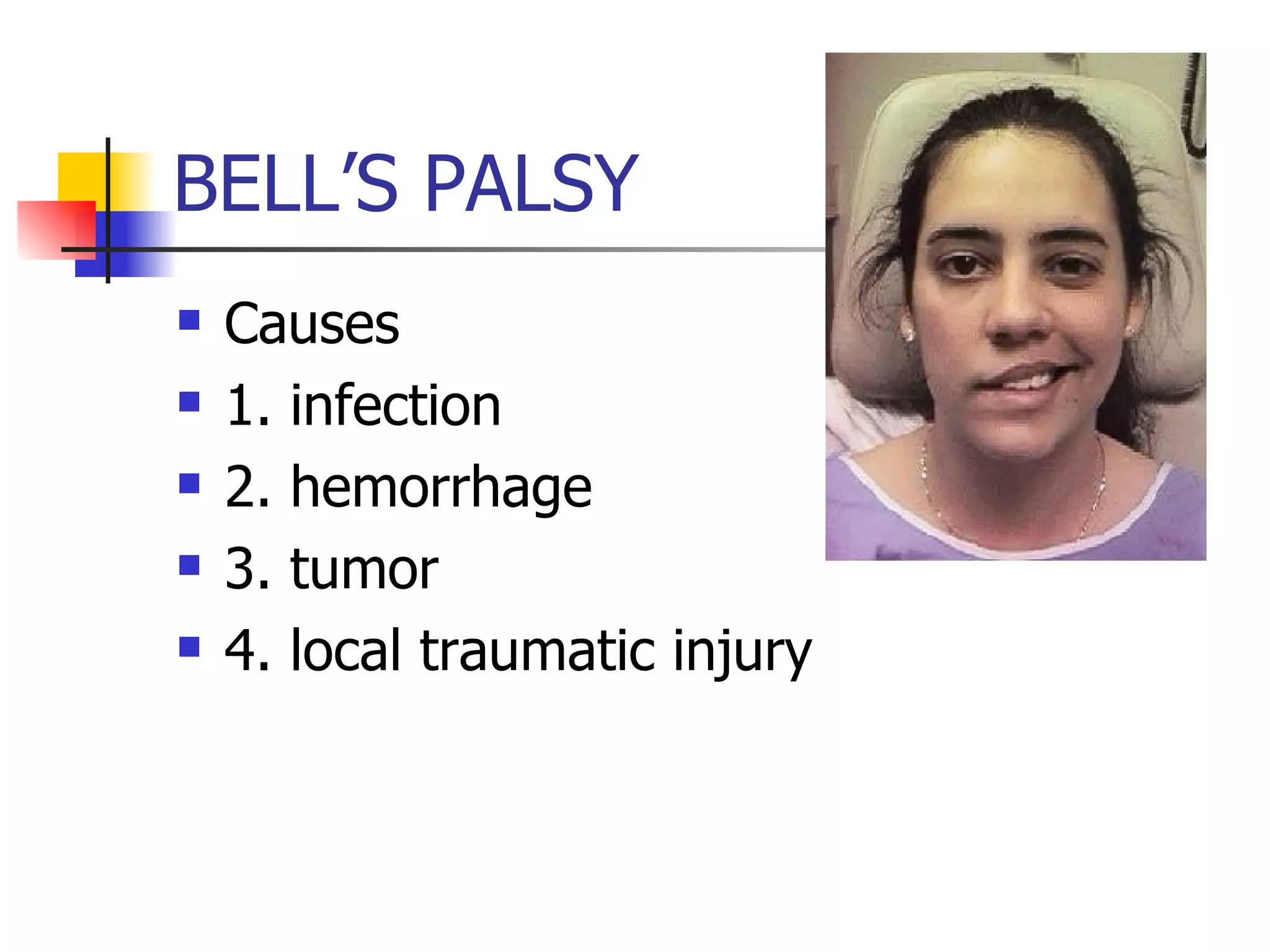 BELL’S PALSY Causes 1. infection 2. hemorrhage 3. tumor 4. local traumatic injury 