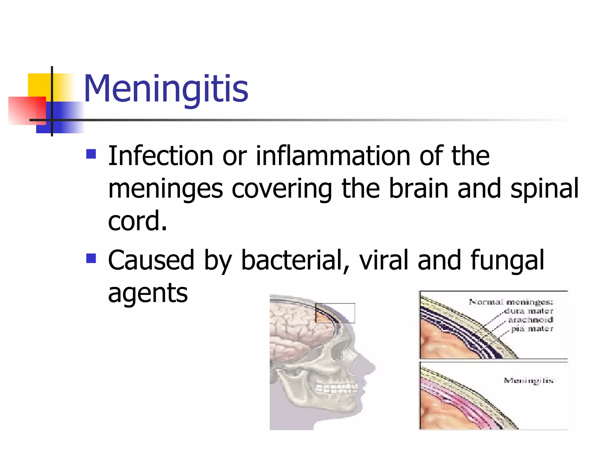 Meningitis Infection or inflammation of the meninges covering the brain and spinal cord. Caused by bacterial, viral and fungal agents 