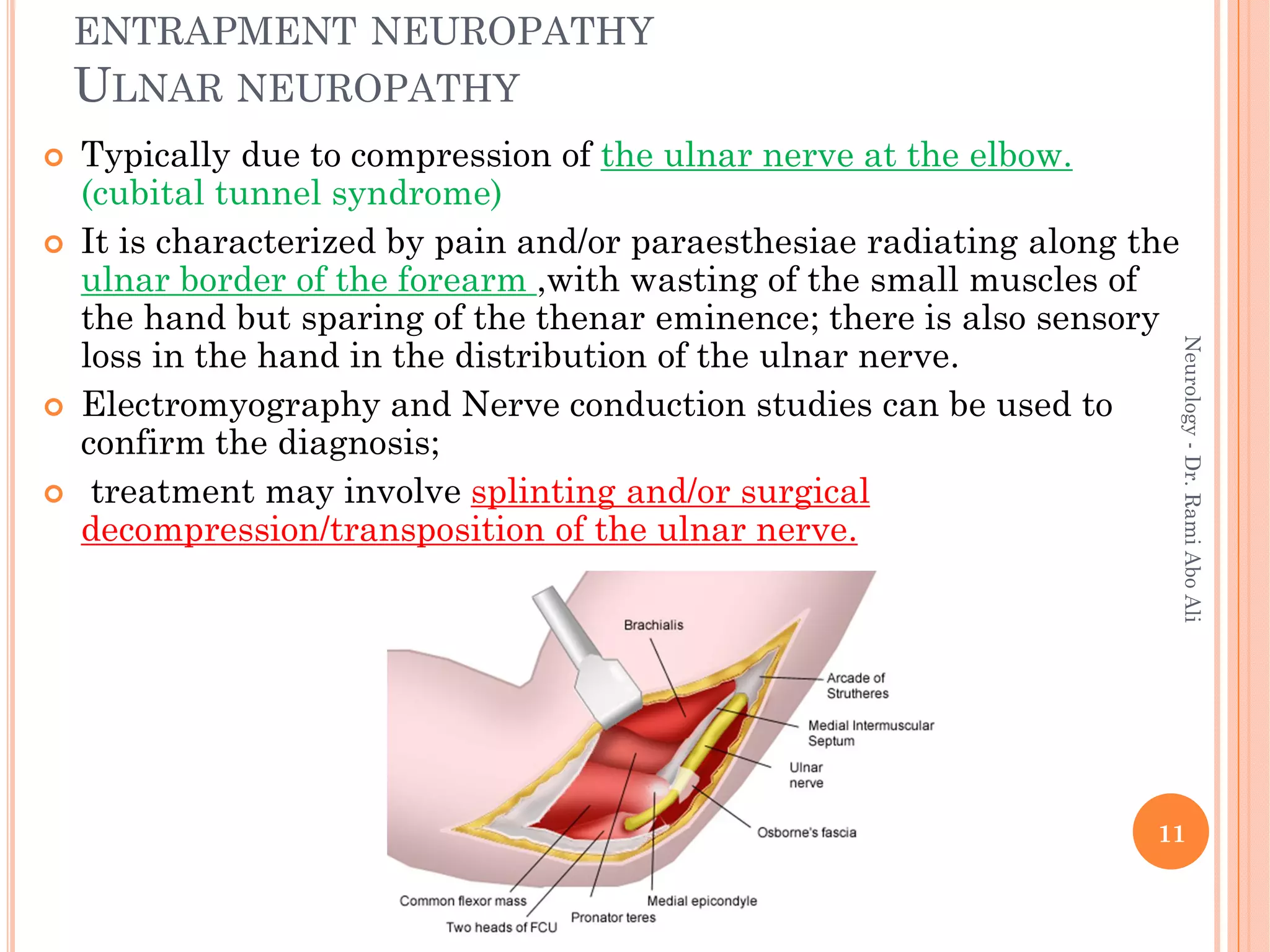 ENTRAPMENT NEUROPATHY
ULNAR NEUROPATHY
 Typically due to compression of the ulnar nerve at the elbow.
(cubital tunnel syndrome)
 It is characterized by pain and/or paraesthesiae radiating along the
ulnar border of the forearm ,with wasting of the small muscles of
the hand but sparing of the thenar eminence; there is also sensory
loss in the hand in the distribution of the ulnar nerve.
 Electromyography and Nerve conduction studies can be used to
confirm the diagnosis;
 treatment may involve splinting and/or surgical
decompression/transposition of the ulnar nerve.
11
Neurology
-
Dr.
Rami
Abo
Ali
 