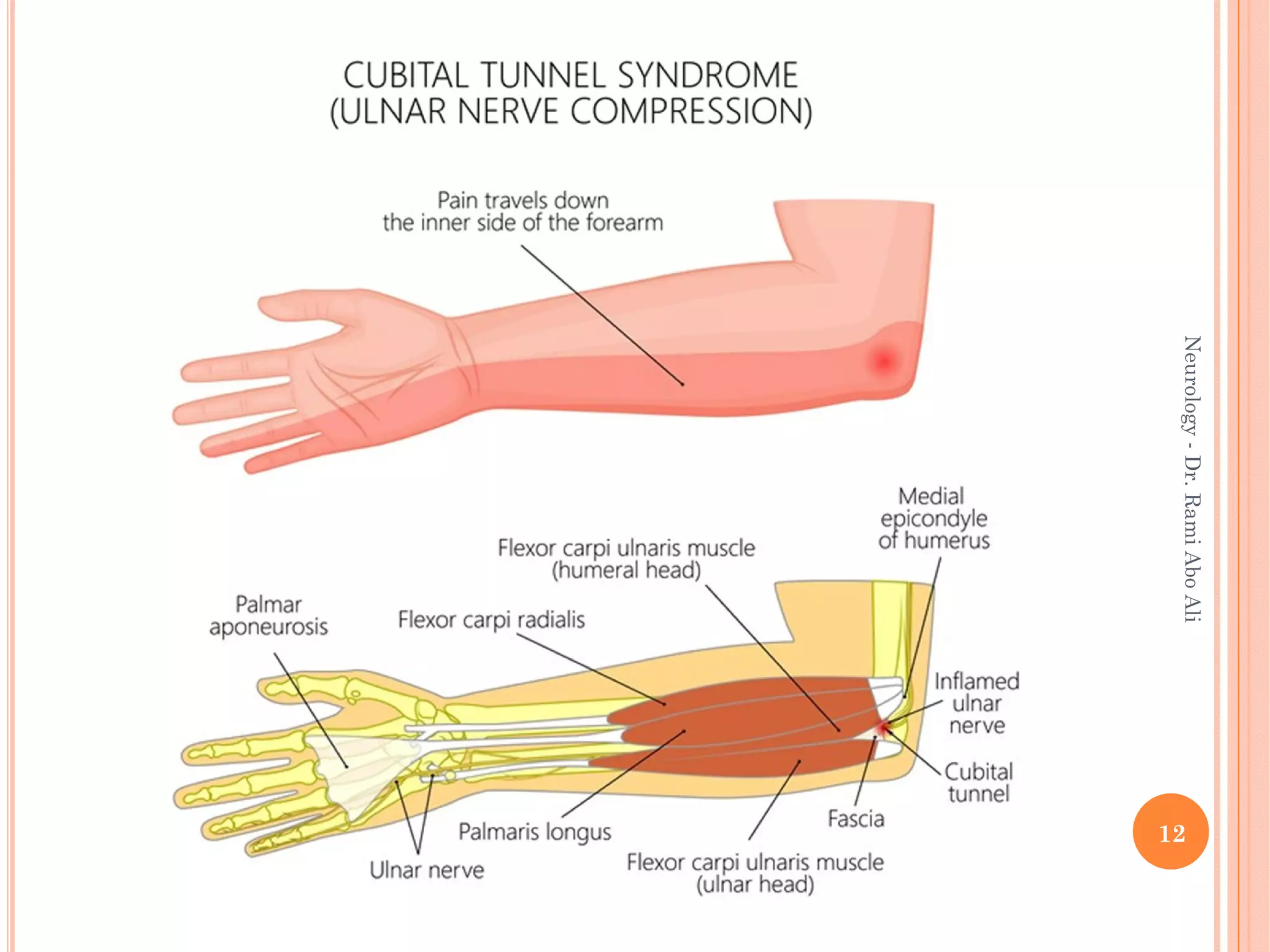 12
Neurology
-
Dr.
Rami
Abo
Ali
 