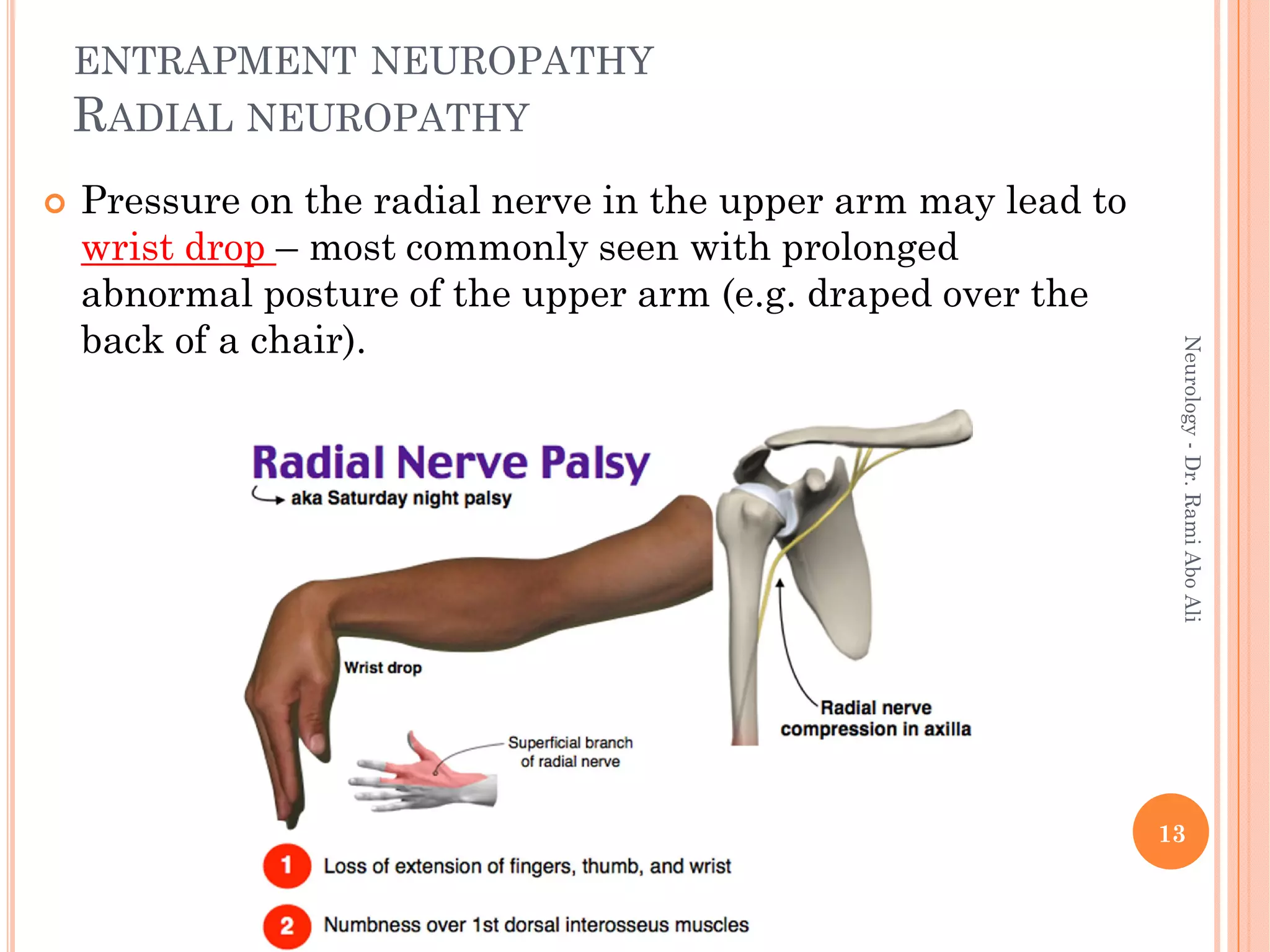 ENTRAPMENT NEUROPATHY
RADIAL NEUROPATHY
 Pressure on the radial nerve in the upper arm may lead to
wrist drop – most commonly seen with prolonged
abnormal posture of the upper arm (e.g. draped over the
back of a chair).
13
Neurology
-
Dr.
Rami
Abo
Ali
 