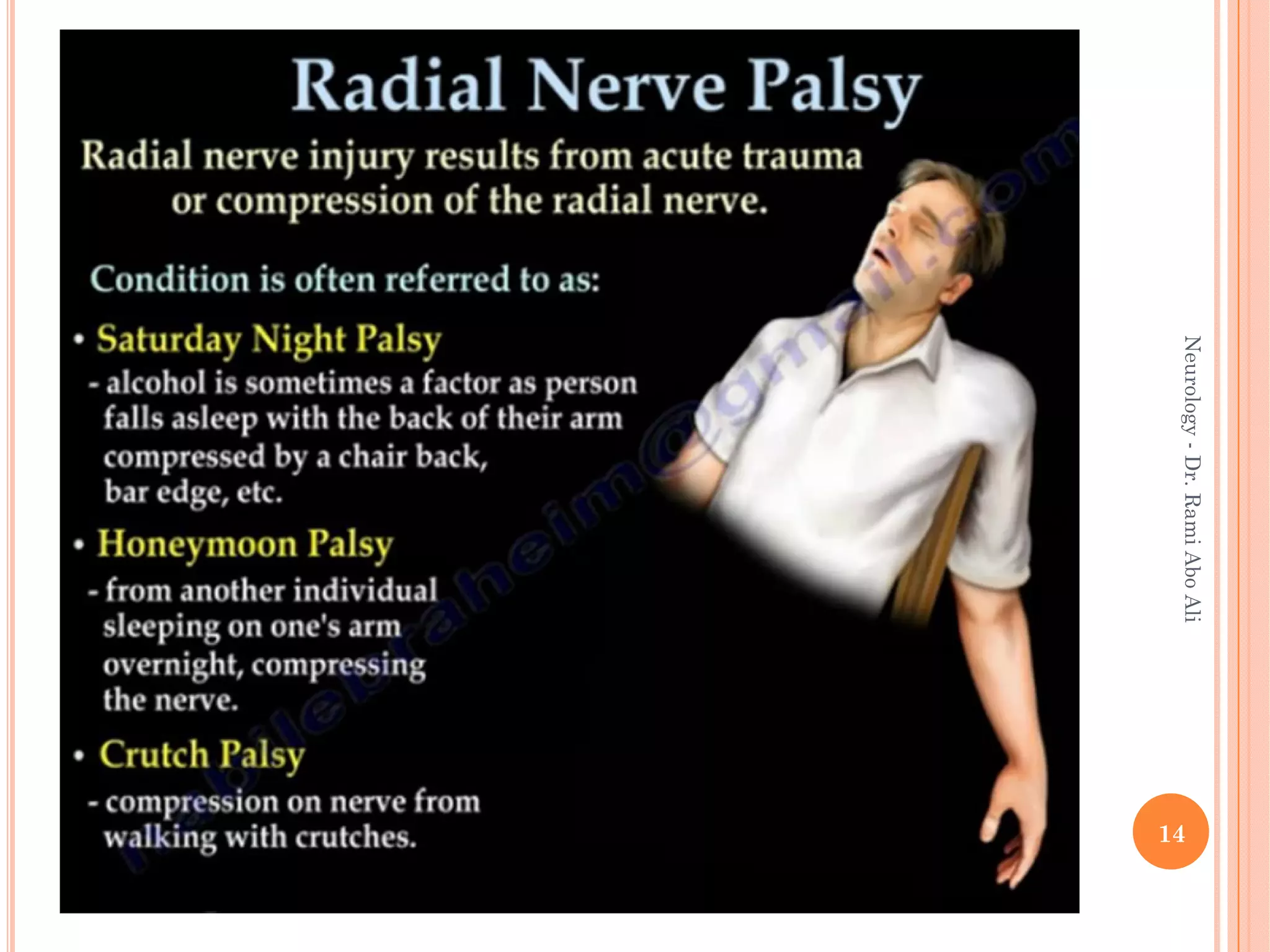 14
Neurology
-
Dr.
Rami
Abo
Ali
 