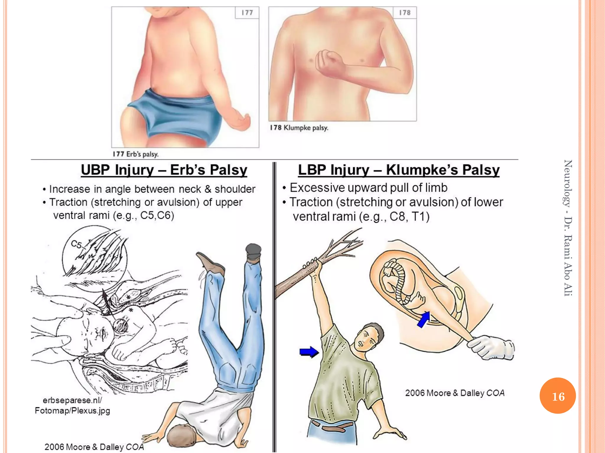 16
Neurology
-
Dr.
Rami
Abo
Ali
 