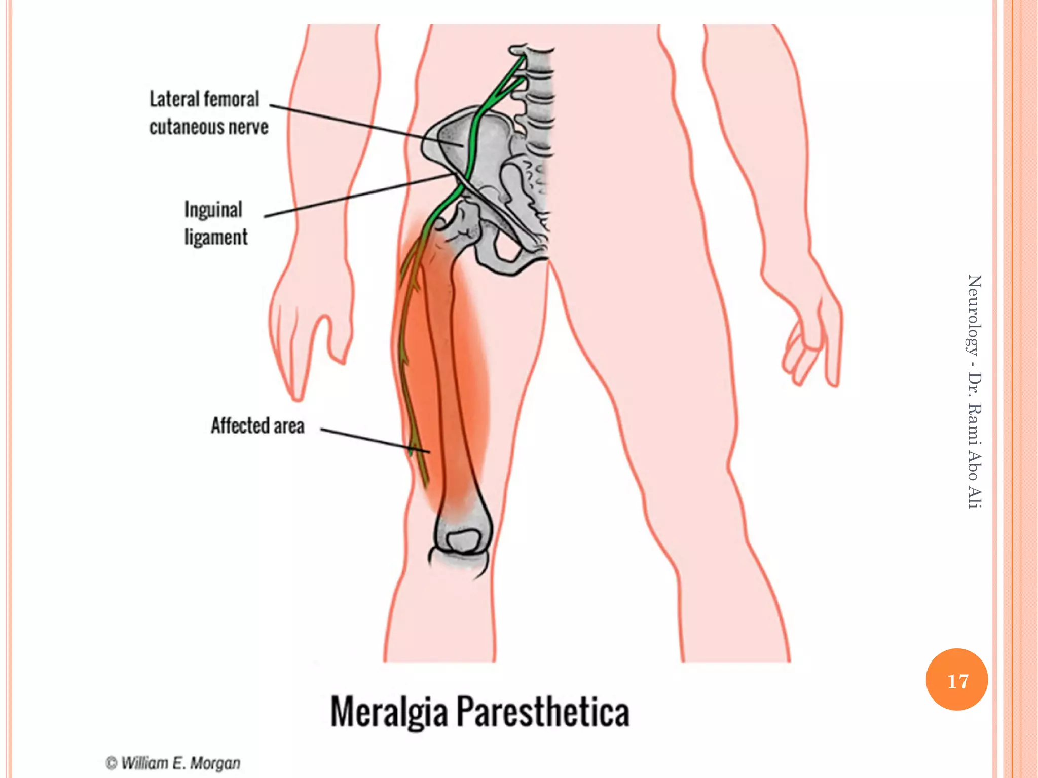 17
Neurology
-
Dr.
Rami
Abo
Ali
 