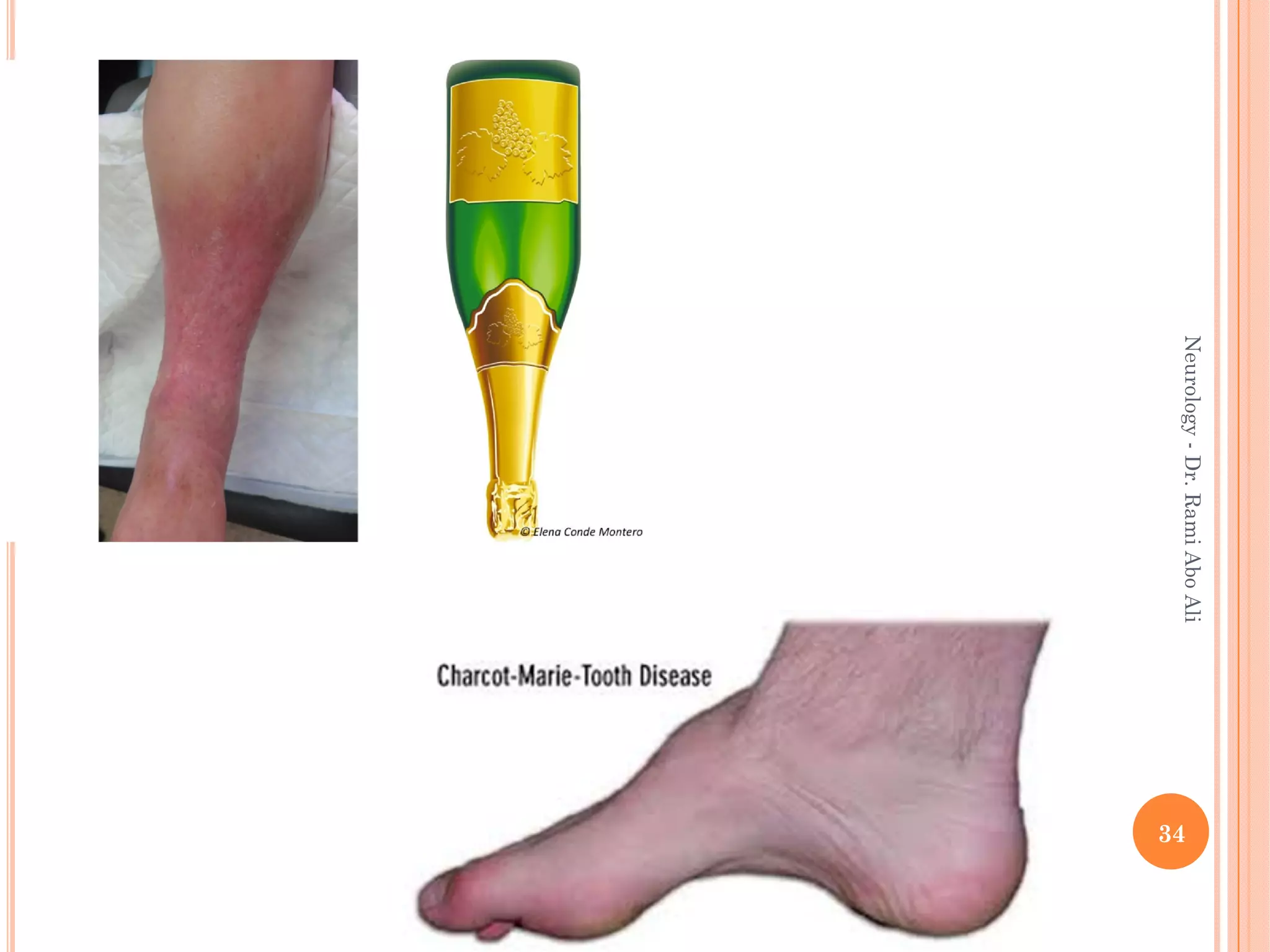 34
Neurology
-
Dr.
Rami
Abo
Ali
 