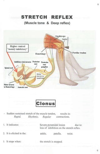 STRETCH REFLEX
(Muscle tone & Deep reflex)
Higher control
"mainly inhibitory"
Inhibitoryintemeuron Posterior
root
"~I
lc1onusl
- Sudden sustained stretch ofthe muscle tendon, results in:
Rapid, Rhythmic, Regular contractions.
1. It indicates: Severe pyramidal lesion due to:
loss of inhibition on the stretch reflex.
2. It is elicited in the: ankle, patella, wrist.
3. It stops when: the stretch is stopped.
9
9
 
