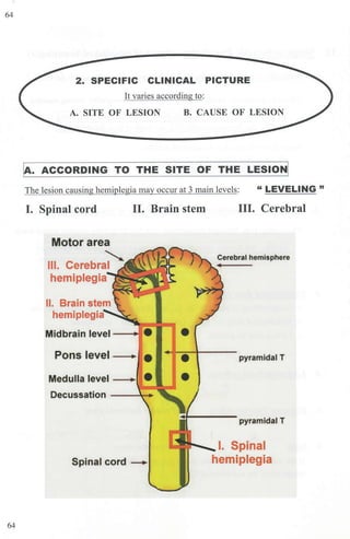 64
64
2. SPECIFIC CLINICAL PICTURE
It varies according to:
A. SITE OF LESION B. CAUSE OF LESION
~- ACCORDING TO THE SITE OF THE LESION!
The lesion causing hemiplegia may occur at 3 main levels: " LEVELiNG "
I. Spinal cord II. Brain stem
Motor area
~
Ill. Cerebral
hemiplegia
II. Brain stem
hemiplegia
Midbrain level - -
Pons level ----
•
Medulla level - -
Decussation - -~-
Spinal cord ---+
•
•
III. Cerebral
Cerebral hemisphere
pyramidal T
pyramidal T
I. Spinal
hemiplegia
 