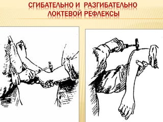 СГИБАТЕЛЬНО И РАЗГИБАТЕЛЬНО
ЛОКТЕВОЙ РЕФЛЕКСЫ
 