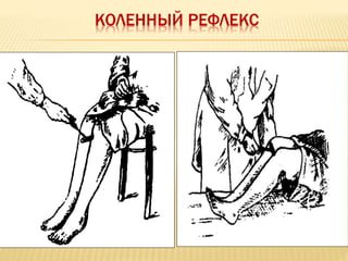 КОЛЕННЫЙ РЕФЛЕКС
 