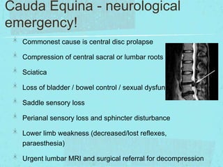 Cauda Equina - neurological
emergency!
Commonest cause is central disc prolapse

Compression of central sacral or lumbar roots
Sciatica

Loss of bladder / bowel control / sexual dysfunction
Saddle sensory loss

Perianal sensory loss and sphincter disturbance
Lower limb weakness (decreased/lost reflexes,
paraesthesia)
Urgent lumbar MRI and surgical referral for decompression

 