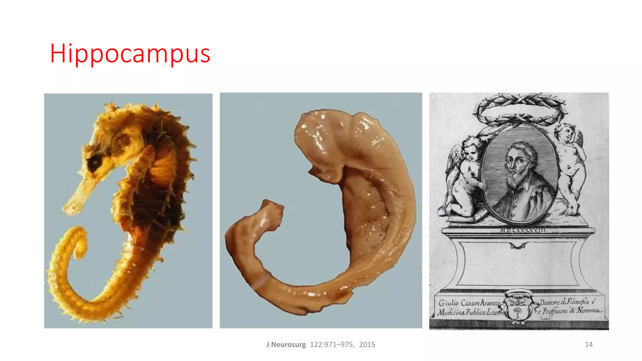 Hippocampus
J Neurosurg 122:971–975, 2015 14
 