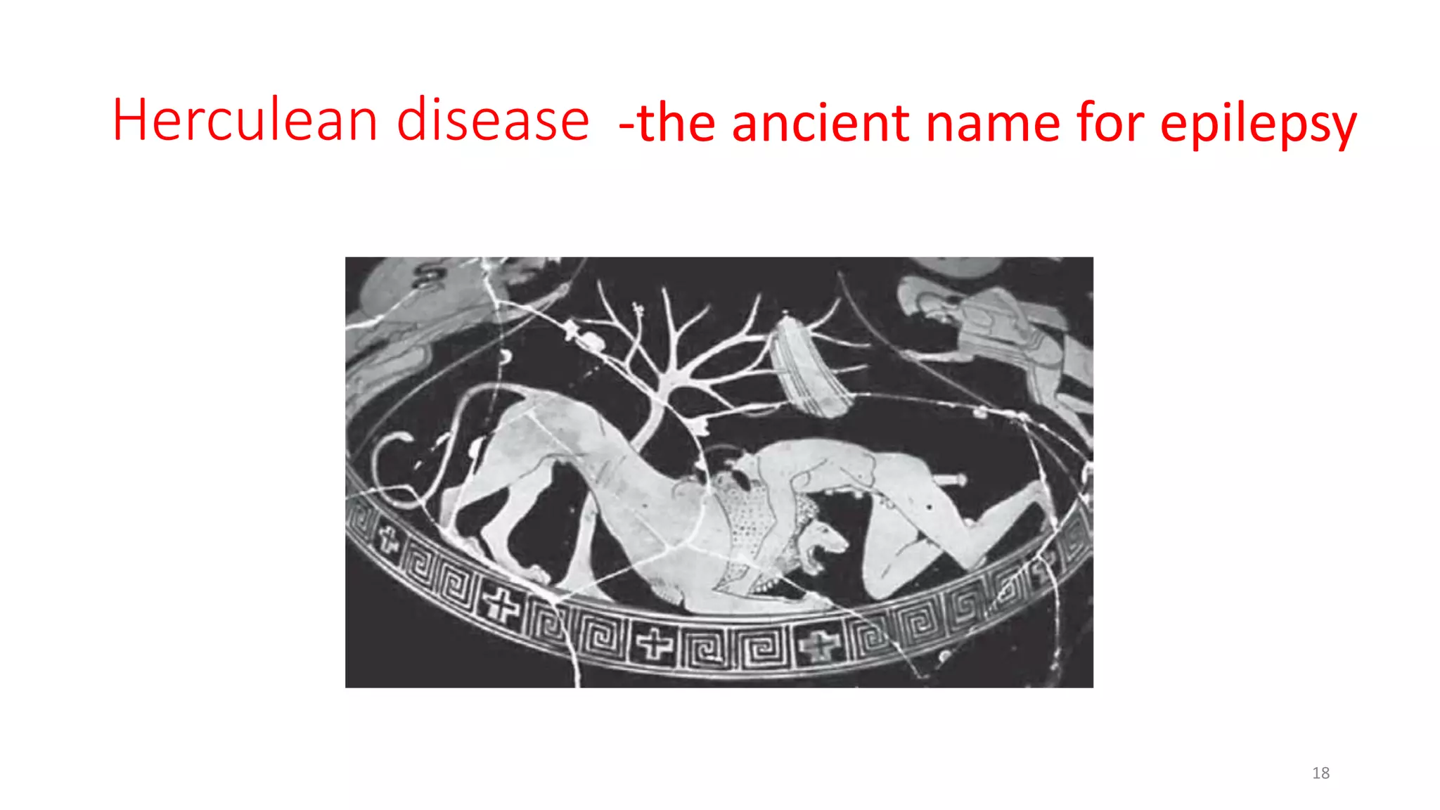 Herculean disease
18
-the ancient name for epilepsy
 