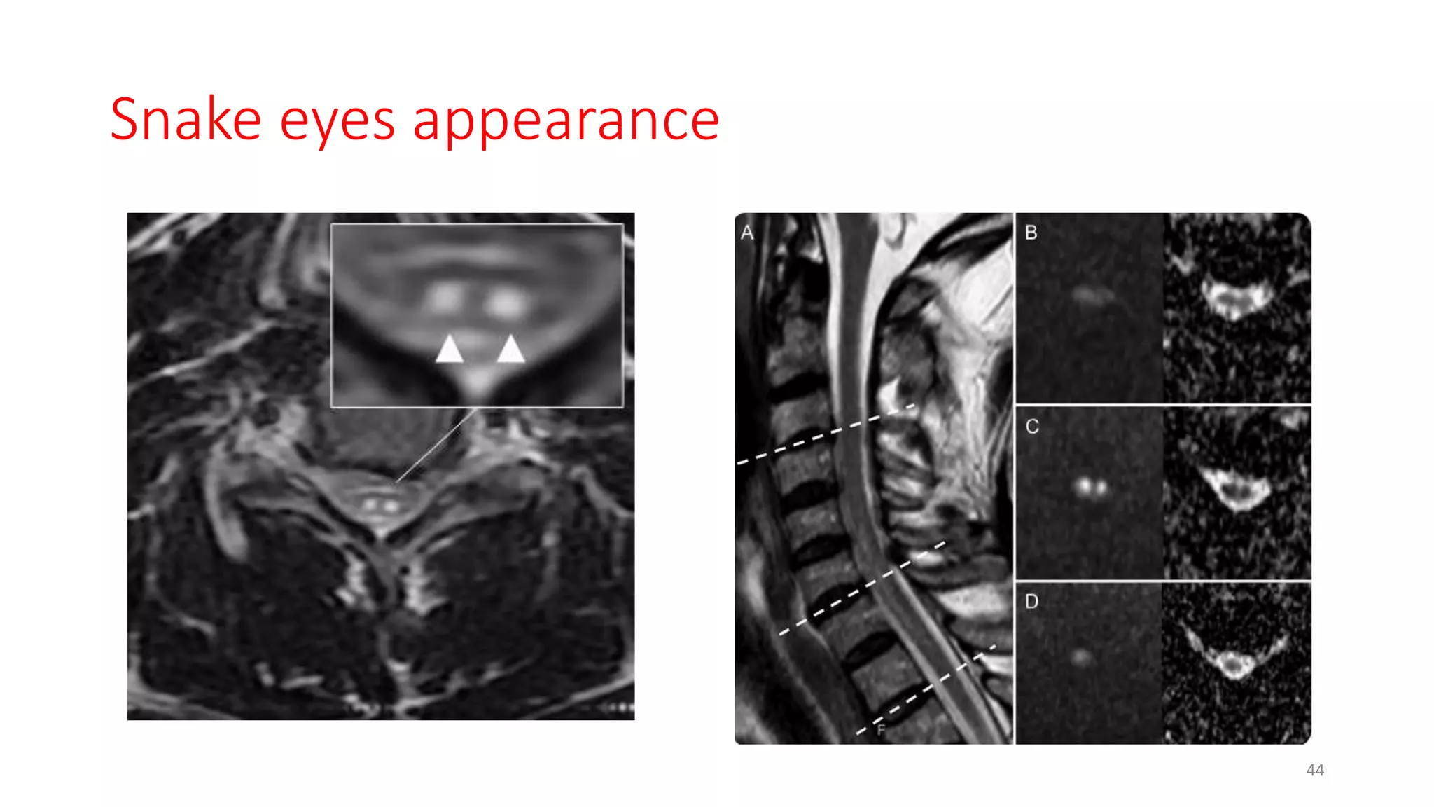 Snake eyes appearance
44
 