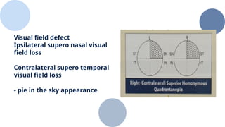 Contralateral Processing For Vision Vision............,................pptx. | PPTX