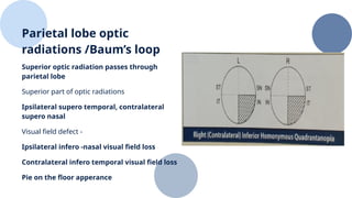 Contralateral Processing For Vision Vision............,................pptx. | PPTX