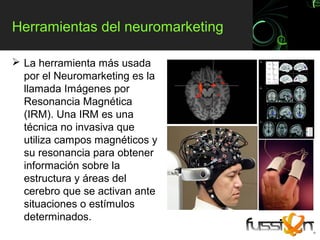 Herramientas del neuromarketing

 La herramienta más usada
  por el Neuromarketing es la
  llamada Imágenes por
  Resonancia Magnética
  (IRM). Una IRM es una
  técnica no invasiva que
  utiliza campos magnéticos y
  su resonancia para obtener
  información sobre la
  estructura y áreas del
  cerebro que se activan ante
  situaciones o estímulos
  determinados.
 