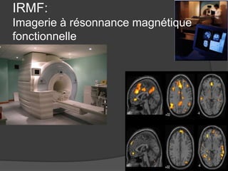 IRMF:
Imagerie à résonnance magnétique
fonctionnelle

 