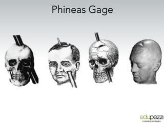 Phineas Gage
 