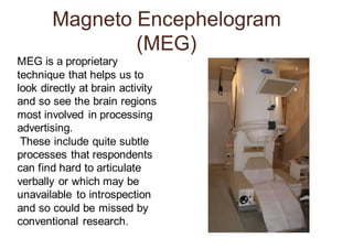 Magneto Encephelogram
(MEG)
MEG is a proprietary
technique that helps us to
look directly at brain activity
and so see the brain regions
most involved in processing
advertising.
These include quite subtle
processes that respondents
can find hard to articulate
verbally or which may be
unavailable to introspection
and so could be missed by
conventional research.
 