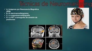  A. Imágenes por Resonancia Magnética
(IRM)
 B. El electroencefalograma
 C. La magnetoencefalografía
 D. La PET o tomografía de emisión de
positrones
 