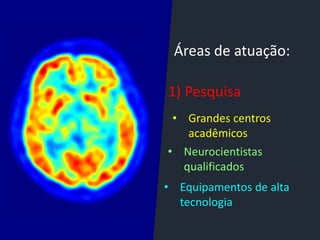 Áreas de atuação:
1) Pesquisa
• Grandes centros
acadêmicos
• Neurocientistas
qualificados
• Equipamentos de alta
tecnologia
 