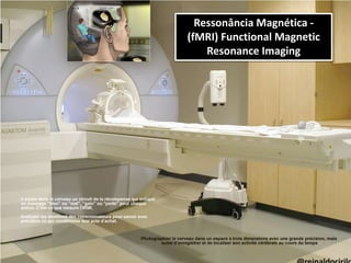 Ressonância Magnética -
(fMRI) Functional Magnetic
Resonance Imaging
 