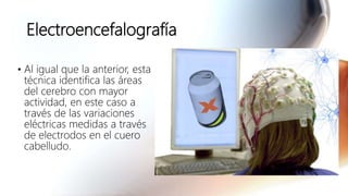 Electroencefalografía
• Al igual que la anterior, esta
técnica identifica las áreas
del cerebro con mayor
actividad, en este caso a
través de las variaciones
eléctricas medidas a través
de electrodos en el cuero
cabelludo.
 