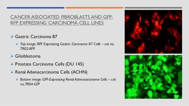 CANCER ASSOCIATED FIBROBLASTS AND GFP-
RFP EXPRESSING CARCINOMA CELL LINES
➢ Gastric Carcinoma 87
➢ Top image: RFP Expressing Gastric Carcinoma 87 Cells – cat no.
TR02-RFP
➢ Glioblastoma
➢ Prostate Carcinoma Cells (DU 145)
➢ Renal Adenocarcinoma Cells (ACHN)
➢ Bottom image: GFP-Expressing Renal Adenocarcinoma Cells – cat
no.TR04-GFP
 