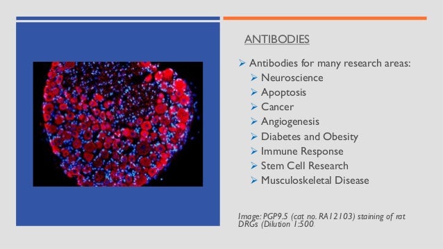 ANTIBODIES
➢ Antibodies for many research areas:
➢ Neuroscience
➢ Apoptosis
➢ Cancer
➢ Angiogenesis
➢ Diabetes and Obesity
➢ Immune Response
➢ Stem Cell Research
➢ Musculoskeletal Disease
Image: PGP9.5 (cat no. RA12103) staining of rat
DRGs (Dilution 1:500)
 