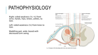 PATHOPHYSIOLOGY
Right-sided weakness (⅗-⅘) from
wrist, hands, hips, knees, ankles, to
toes
Left-sided weakness (⅘) from kn...