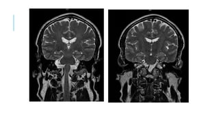 CERVICAL CONTRAST MRI
4/17/2010
 