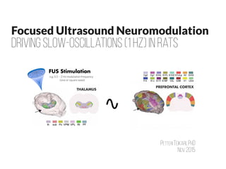 Focused Ultrasound Neuromodulation
Driving Slow-Oscillations (1 Hz) in rats
Petteri Teikari, PhD
Nov 2015
 
