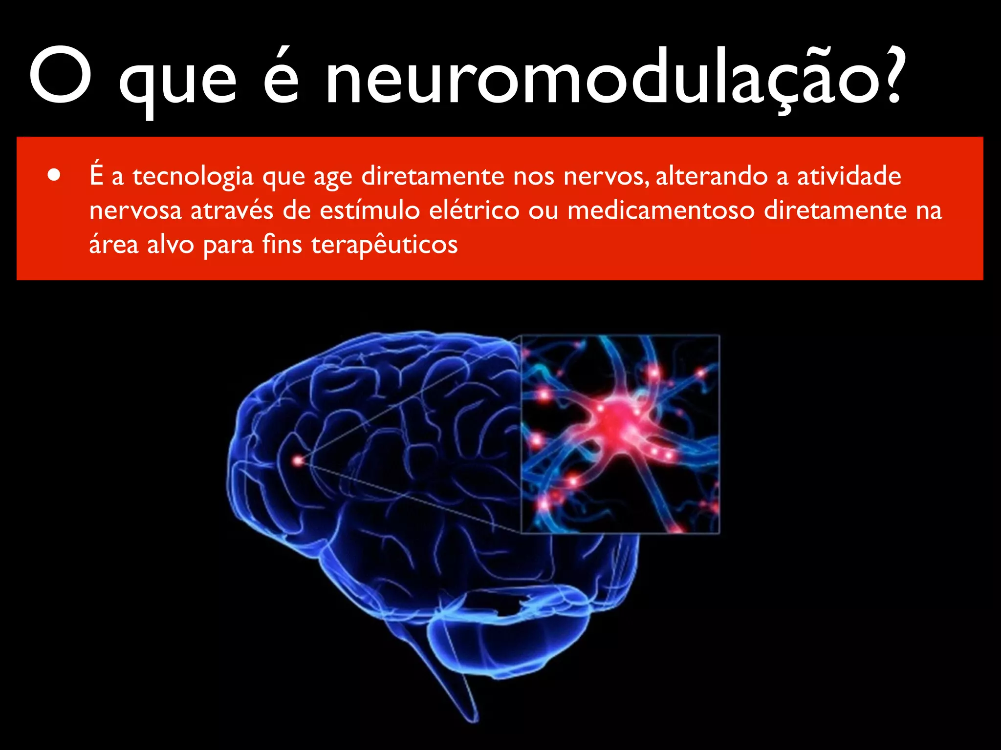 Neuromodulação Cerebral com Estimulação Magnética Transcraniana na Dor ...