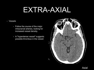 EXTRA-AXIAL
Axial
• Vessels
• Follow the course of the major
intracranial arteries, looking for
increased vessel density.
• A "hyperdense vessel" suggests
possible thrombus in the vessel.
 