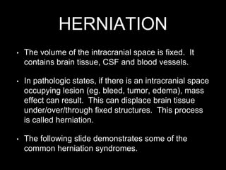 HERNIATION
• The volume of the intracranial space is fixed. It
contains brain tissue, CSF and blood vessels.
• In pathologic states, if there is an intracranial space
occupying lesion (eg. bleed, tumor, edema), mass
effect can result. This can displace brain tissue
under/over/through fixed structures. This process
is called herniation.
• The following slide demonstrates some of the
common herniation syndromes.
 