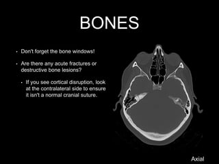 BONES
• Don't forget the bone windows!
• Are there any acute fractures or
destructive bone lesions?
• If you see cortical disruption, look
at the contralateral side to ensure
it isn't a normal cranial suture.
Axial
 