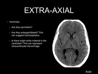 EXTRA-AXIAL
• Ventricles:
• Are they symmetric?
• Are they enlarged/dilated? This
can suggest hydrocephalus.
• Is there bright white material in the
ventricles? This can represent
intraventricular hemorrhage.
Axial
 
