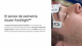 Foresight O2 Sensor Neuromonitoreo-en-Cirugia cardiovascular | PPTX