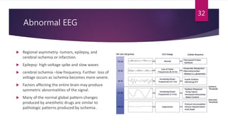 Neuromonitoring | PPTX