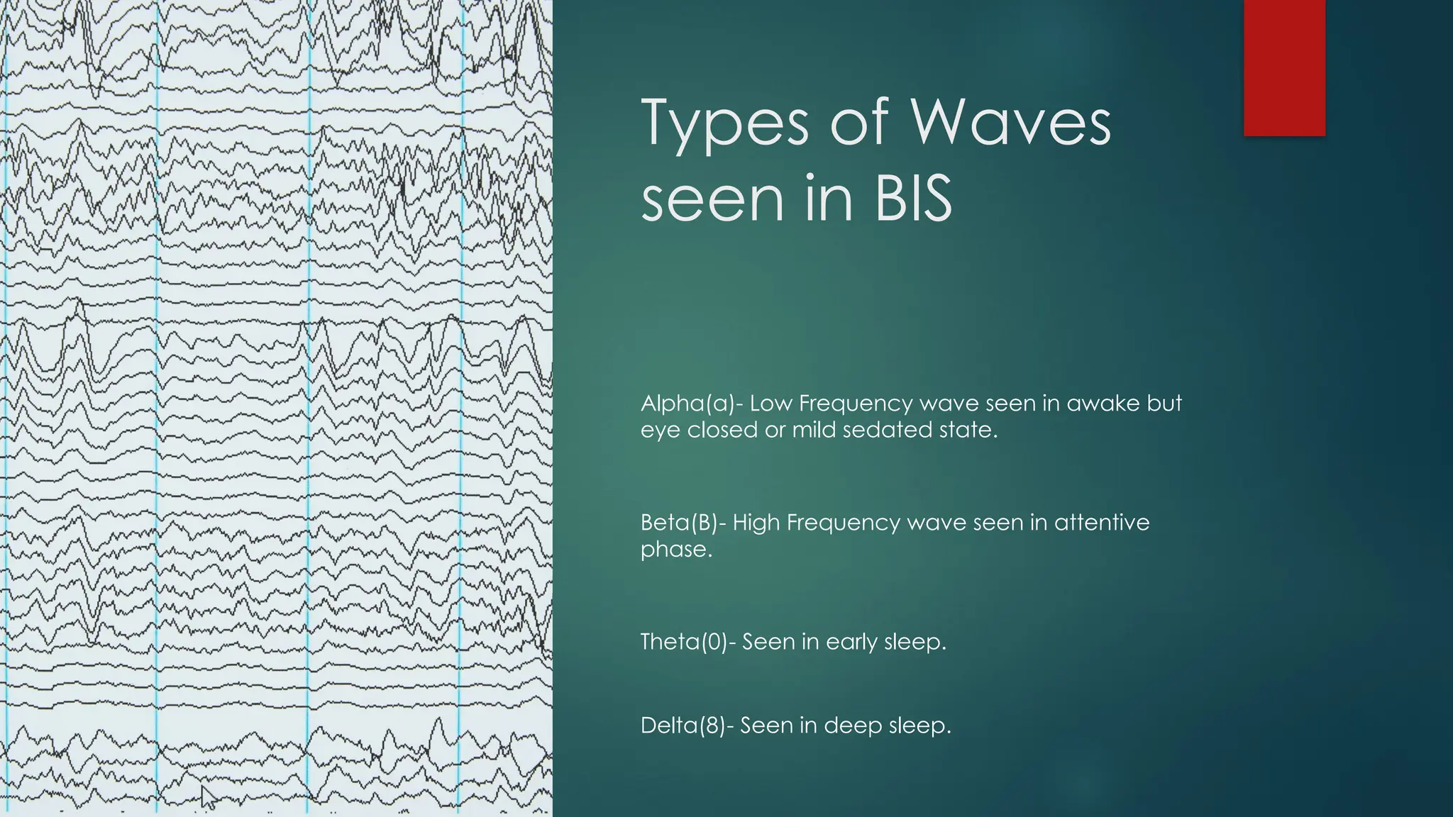 Types of Waves
seen in BIS
Alpha(a)- Low Frequency wave seen in awake but
eye closed or mild sedated state.
Beta(B)- High Frequency wave seen in attentive
phase.
Theta(0)- Seen in early sleep.
Delta(8)- Seen in deep sleep.
 