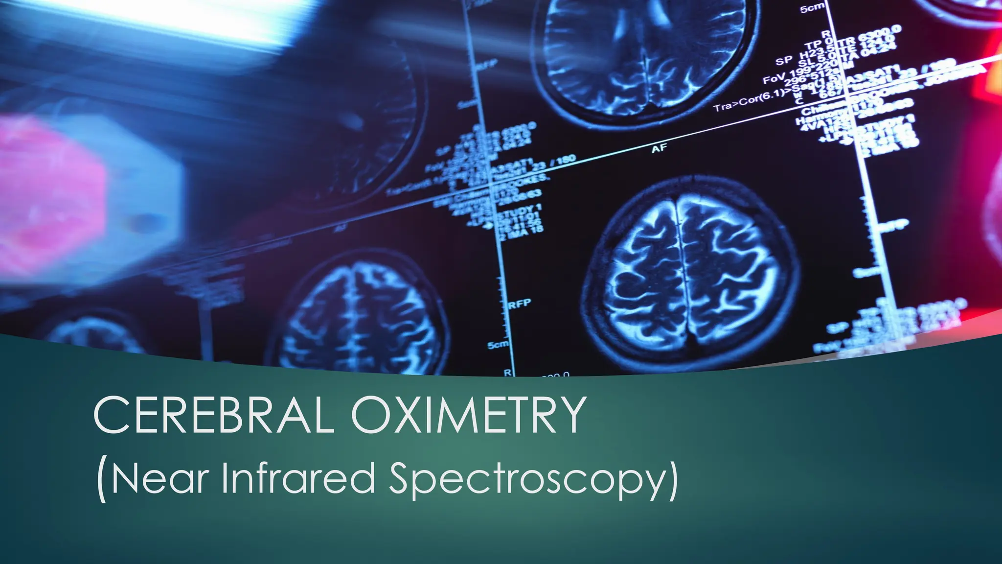 CEREBRAL OXIMETRY
(Near Infrared Spectroscopy)
 
