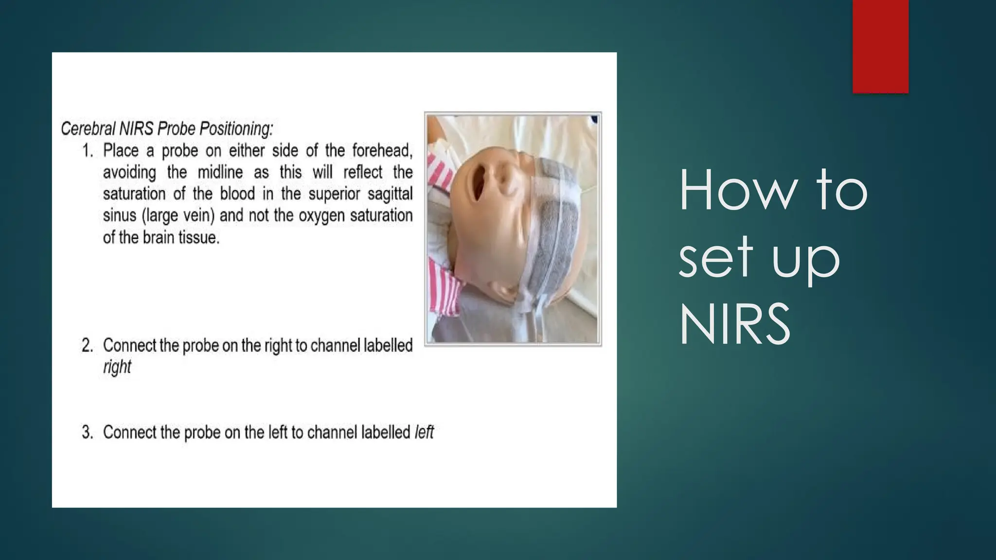How to
set up
NIRS
 