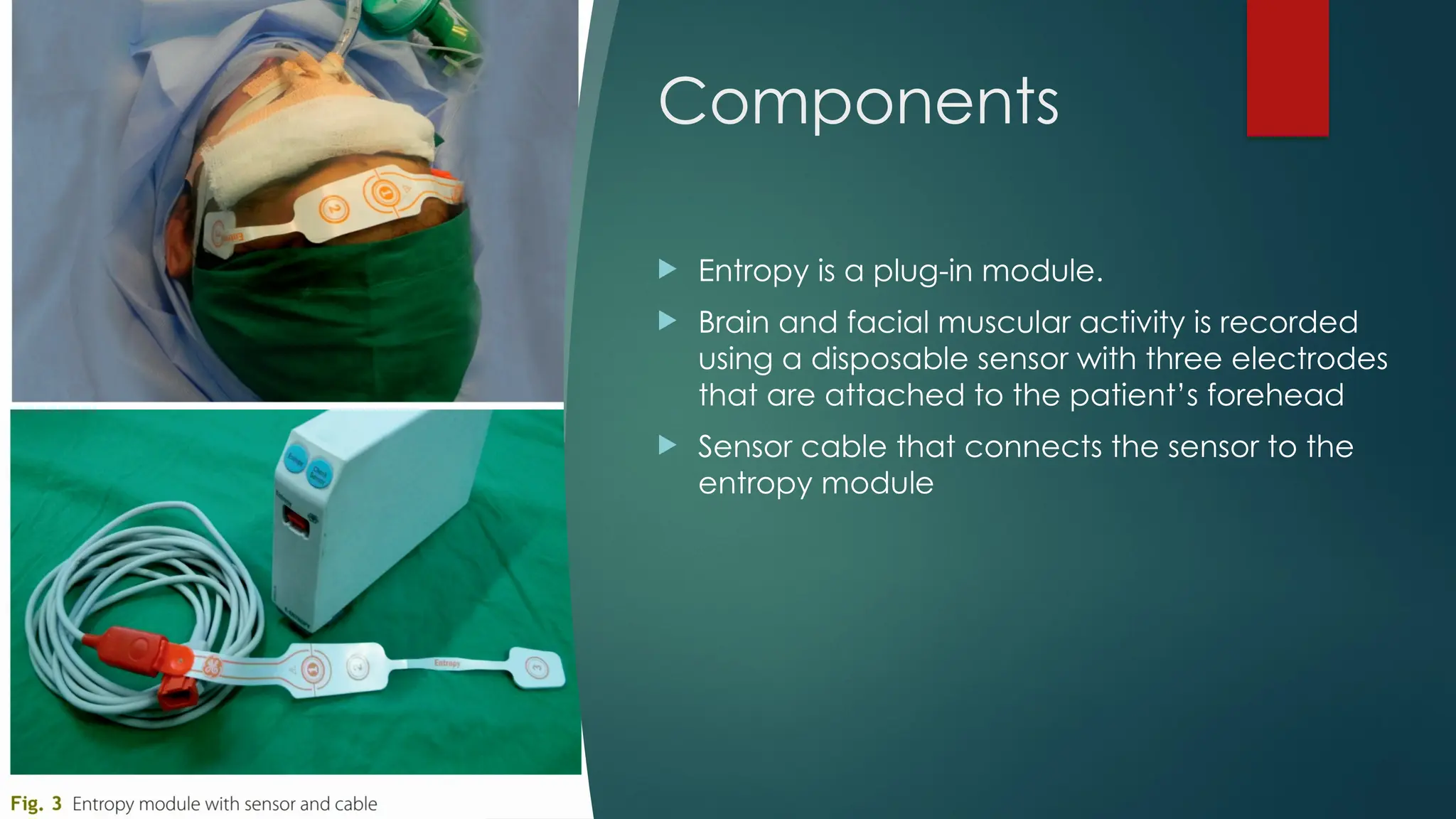 Components
 Entropy is a plug-in module.
 Brain and facial muscular activity is recorded
using a disposable sensor with three electrodes
that are attached to the patient’s forehead
 Sensor cable that connects the sensor to the
entropy module
 