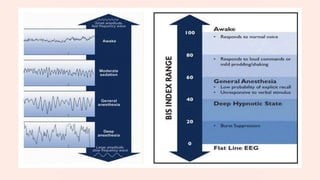 NEUROMONITORING IN ANAESTHESIA | PPTX