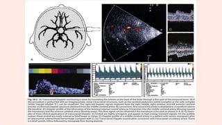 NEUROMONITORING IN ANAESTHESIA | PPTX