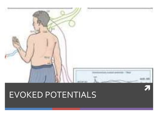 
EVOKED POTENTIALS
 