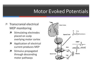 Motor Evoked Potentials
 Transcranial electrical
MEP monitoring
 Stimulating electrodes
placed on scalp
overlying motor cortex
 Application of electrical
current produces MEP
 Stimulus propagated
through descending
motor pathways
 