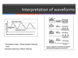 Interpretation of waveforms
Pulsatality Index = (Peak Systolic Velocity
- End
Diastolic Velocity) / Mean Velocity
 