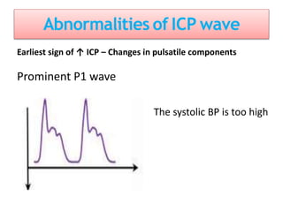 Abnormalities of ICP wave
Earliest sign of ↑ ICP – Changes in pulsatile components
Prominent P1 wave
The systolic BP is too high
 